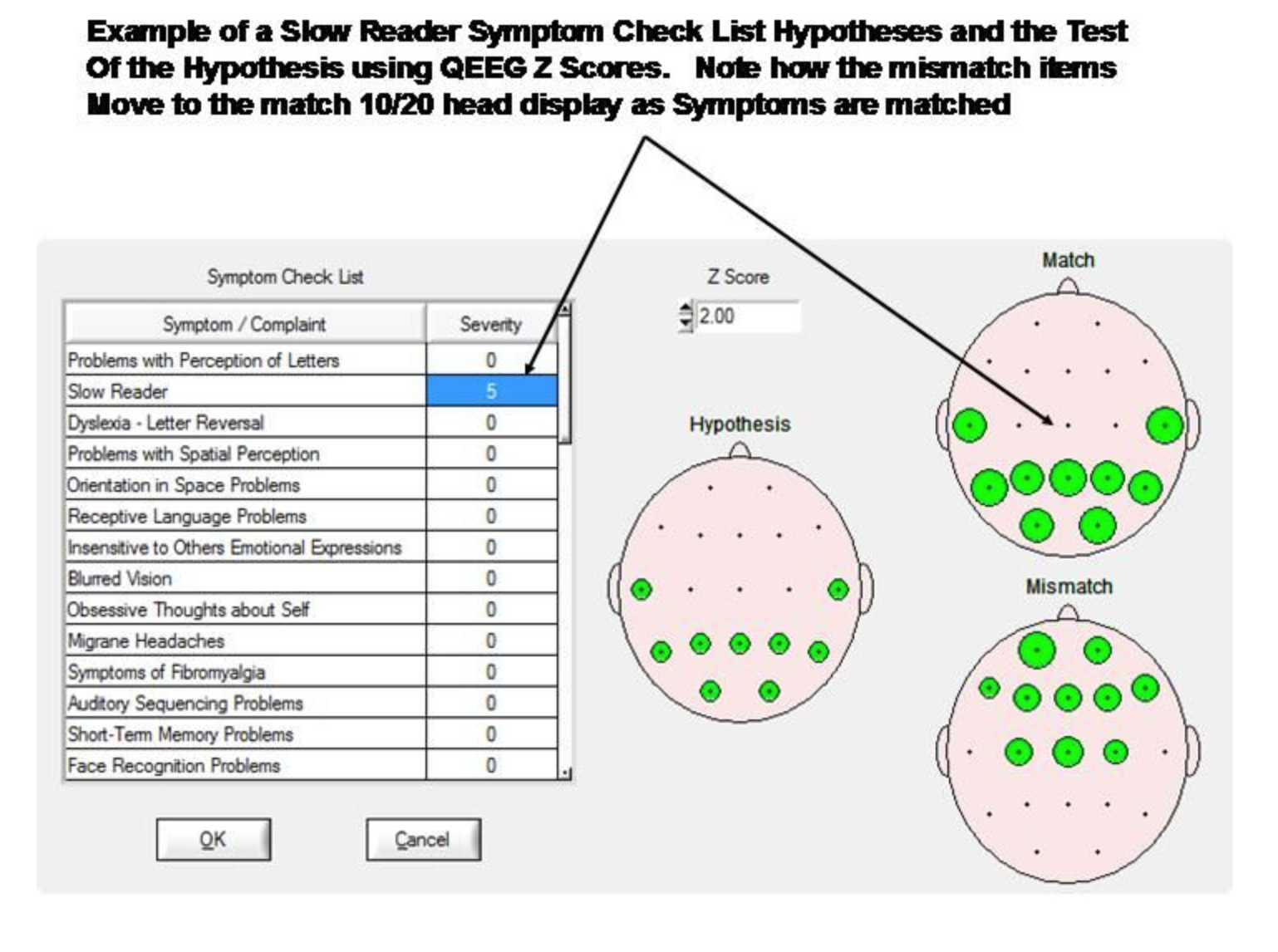 NF 1- 19 Ch. Z-Score Neurofeedback