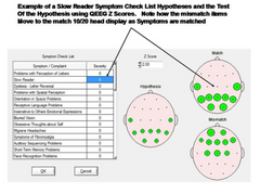 NF 1- 19 Ch. Z-Score Neurofeedback